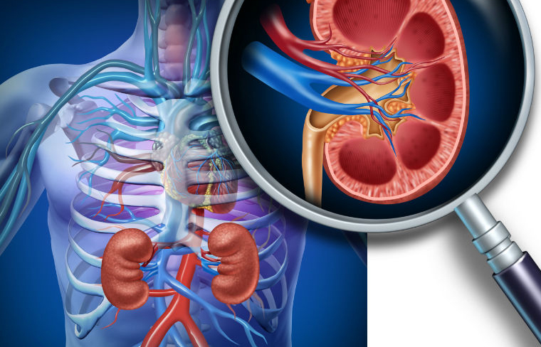 50 % De Los Enfermos Renales Mueren De Complicaciones Cardiovasculares ...