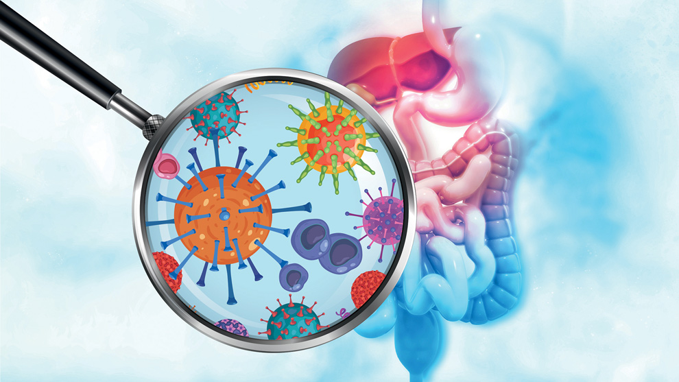 Cuidado Con El Sobrecrecimiento Bacteriano Del Intestino Delgado ...